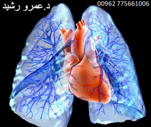 امراض القلب وتأثيرها على الرئة